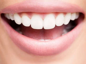 Diş beyazlatan 6 formül