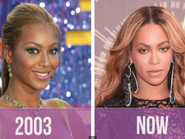 Ünlülerin Eski Hali Çok Şaşırtacak!