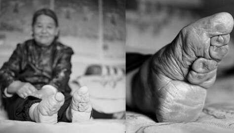 Güzellik değil, adeta Çin işkencesi: Lotus ayaklı kadınlar...