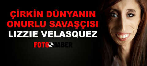 Çirkin dünyanın onurlu savaşçısı: Lizzie Velasquez