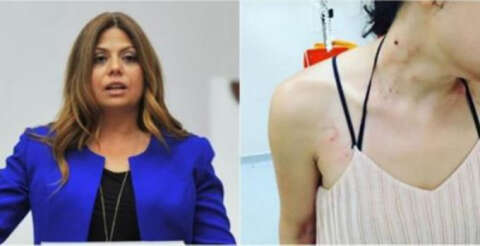 CHP'li vekil Zeynep Altıok, müzisyen Gülşah Erol'un darp edildiği iddialarını TBMM'ye taşıdı