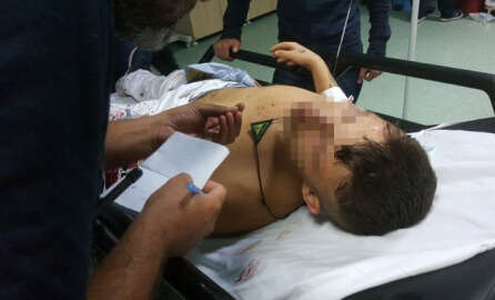 Silahlı saldırıya uğrayan 17 yaşındaki genç ölümden döndü