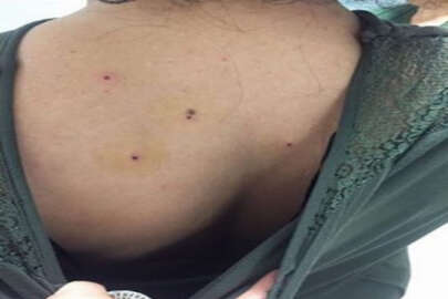 Kına eğlencesinde maganda dehşeti: 10 yaralı