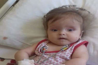 11 aylık Sümeyye’nin yaşı küçük derdi büyük