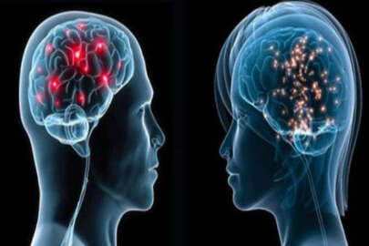 Dünya İQ ortalaması açıklandı: Türkiye kaçıncı sırada?