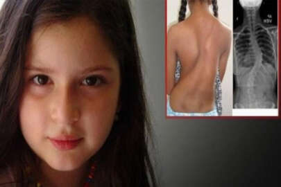 Küçük Melissa yardım elli bekliyor!