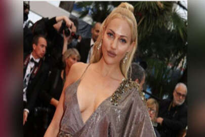 Meryem Uzerli uyarı aldı dolgularını çıkartacak