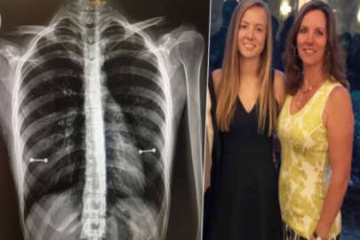 Sosyal medya bunu konuşuyor! Kızının röntgenini görünce çılgına döndü