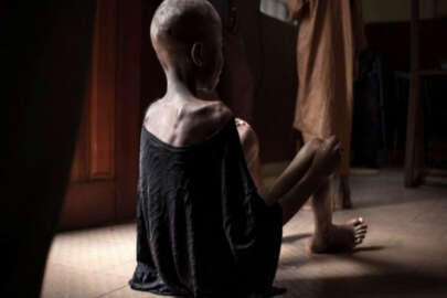 BM'den korkunç rapor! 821 milyondan fazla insan aç