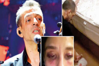 Rubato'nun solisti sevgilisini dövdü mü?