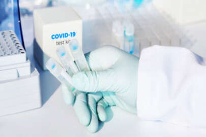 Koronavirüs testi ne zaman yapılmalı?