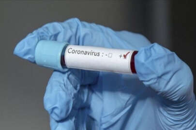 Ölüm riskini ortadan kaldıran Korona ilacı acil kullanım onayı alabilecek mi?