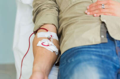 MDS hastalığı belirtileri ve tedavisi