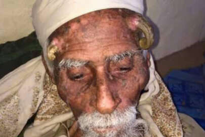 Kafasında boynuz çıkmıştı!