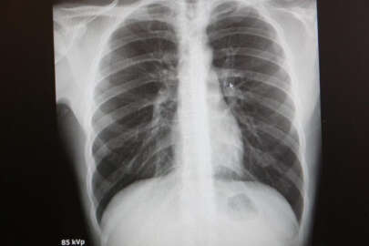 Uzmanlar uyardı... Deprem bölgesinde yeni tehlike!