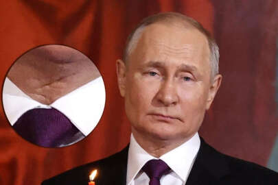 Putin kanser mi oldu?: Boğazındaki iz dikkat çekiyor