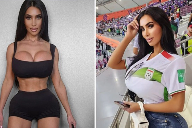 Kim Kardashian’a benzemek isterken 34 yaşında hayatını kaybetti!