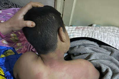 Bursa'da seçim bürosundaki çocuğu kaynar çayla yaktı, tutuklandı!