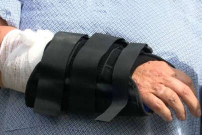 Köpeğini kovalayan ayının burnuna yumruk attı!