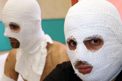 Çakmak gazı tüpü otomobilde patladı!