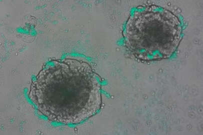 Kanser hücrelerini tespit etmek için bakteriler geliştirildi!