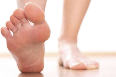 Yanlış ayakkabı seçimi bu hastalığa zemin hazırlıyor!