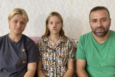 Yüzüne kaldırım taşı atılan genç kız konuştu: Hayatım karardı