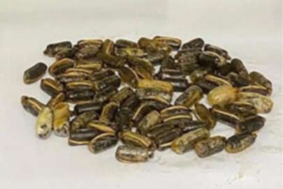 İranlı şüphelinin mide ve bağırsağından çıkan uyuşturucu şoke etti