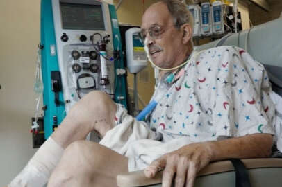 Domuz kalbi nakledilen Faucette hayatını kaybetti!