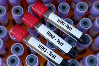 İngiltere'de H1N2 grip türü ilk kez insanda görüldü