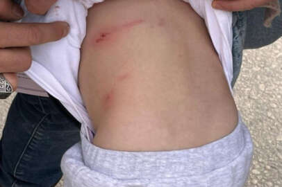 Sivas'ta tasmalı köpek dehşeti