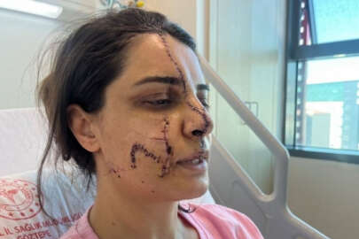 İstanbul'da saldırıya uğrayan kadın yüzündeki 40 dikişle dehşet dolu anları anlattı