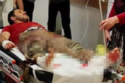 Bursa'da ayakları ve eli kanlar için hastaneye kaldırıldı!