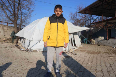 Kuduz köpeğin saldırdığı çocuk: "Beni ısırmayacağını düşünmüştüm ama aniden saldırdı ve ısırdı"