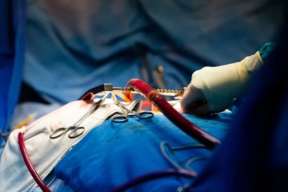 Organ naklinde çığır açacak gelişme!