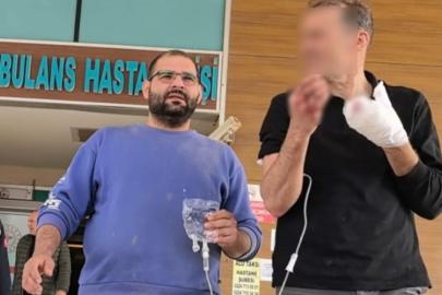 Bursa'da korkunç olay! Parmakları koptu...