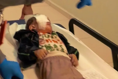 Bursa'da torpil faciasında 2 yaşındaki çocuk ağır yaralandı