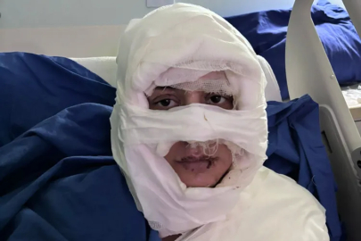 Genç kadın başka bir kadın tarafından ateşe verildi