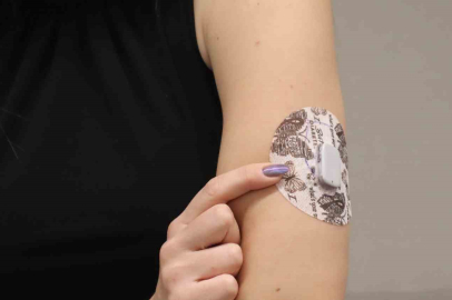 Diyabet tedavisinde yapay zeka destekli teknolojilerle "Yapay Pankreas" dönemi başlıyor