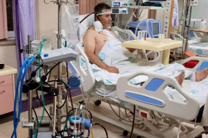 Kalp ameliyatında ECMO başarısı, bir ilk oldu