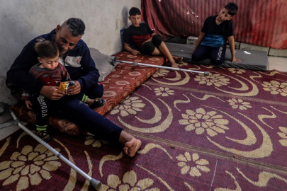 İsrail saldırısında oğlunu ve bir bacağını kaybeden Gazzeli baba, ailesi için yaşama tutunuyor