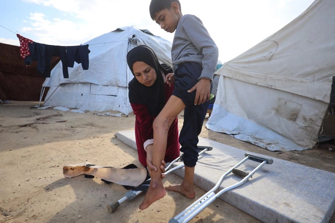 İsrail'in yetim bıraktığı Gazzeli Bilal, hayata tutunmaya çalışıyor