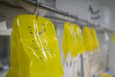 Uzmanlar uyarıyor: Hastane dışında sarı serum taktırmayın!