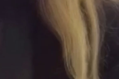 Estetik için gitti hayatının şokunu yaşadı!