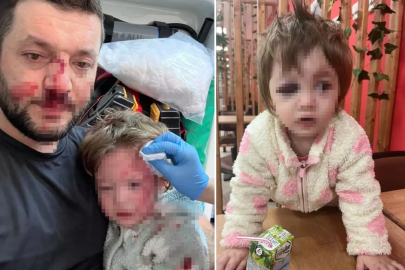 Yalova'da 14 aylık bebeğin yaralandığı olayda pes dedirten savunma