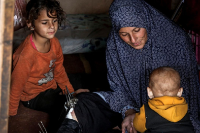 İsrail saldırısında ağır yaralanan Filistinli anne tedavi olmayı bekliyor
