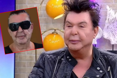 Yüzünü gerdiren Kuşum Aydın'ın şişlikleri indi! Görenler aynı yorumu yaptı