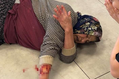 Afyonkarahisar'da başıboş köpek dehşeti! Kadın ağır yaralandı