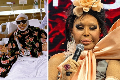 Bülent Ersoy’un lolita estetiği sonrası son hali!